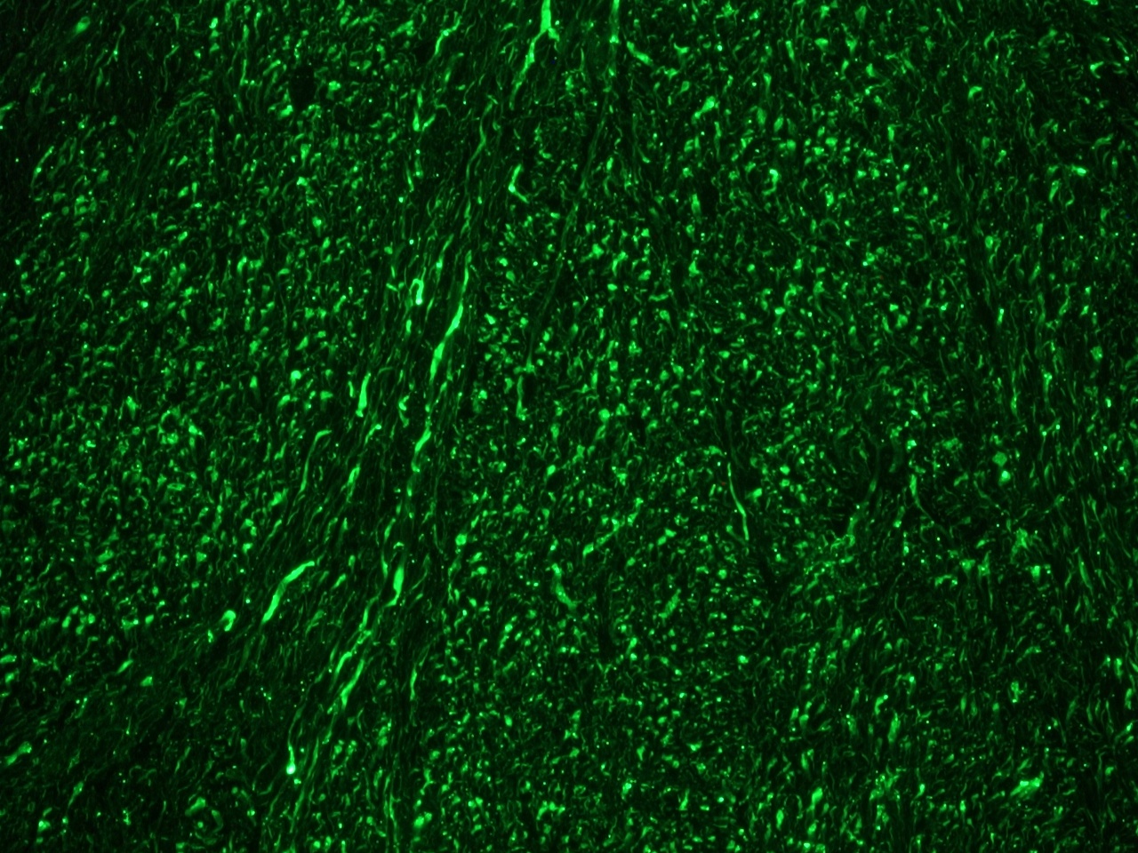 Figure 1. Indirect immunostaining of nerve fibers in a frozen section of rat brain using MUB1305P (clone RNF406) at a 1:100 dilution.